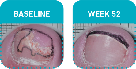 Before and after week 52