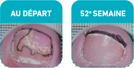 Before and after week 52
